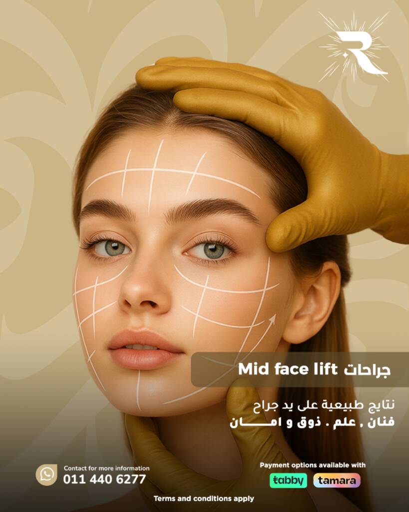 Face Lift